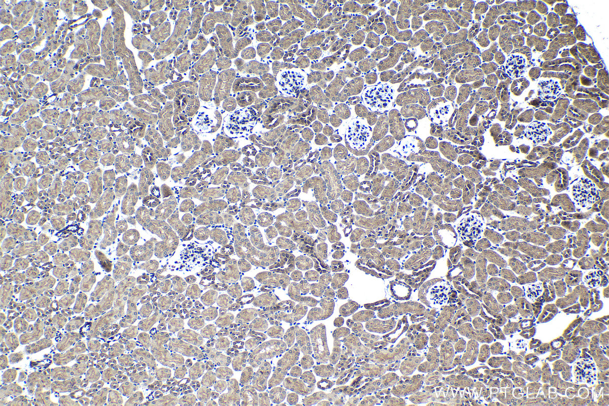 Immunohistochemical analysis of paraffin-embedded mouse kidney tissue slide using KHC1405 (RGS6 IHC Kit).