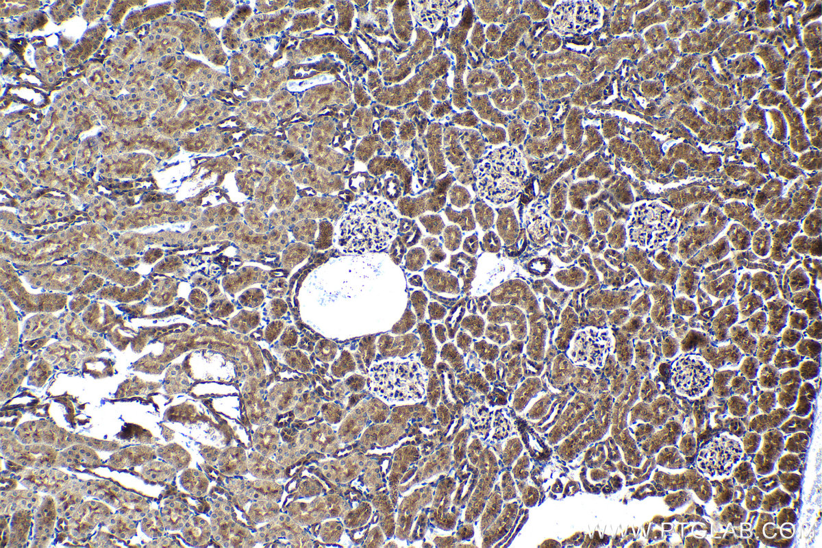 Immunohistochemical analysis of paraffin-embedded rat kidney tissue slide using KHC1405 (RGS6 IHC Kit).