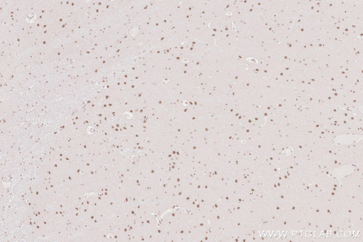 Immunohistochemical analysis of paraffin-embedded rat brain tissue slide using KHC2563 (RNF20 IHC Kit).