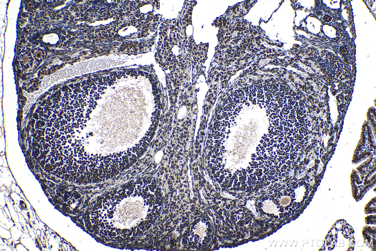 Immunohistochemical analysis of paraffin-embedded mouse ovary tissue slide using KHC1243 (RNF6 IHC Kit).