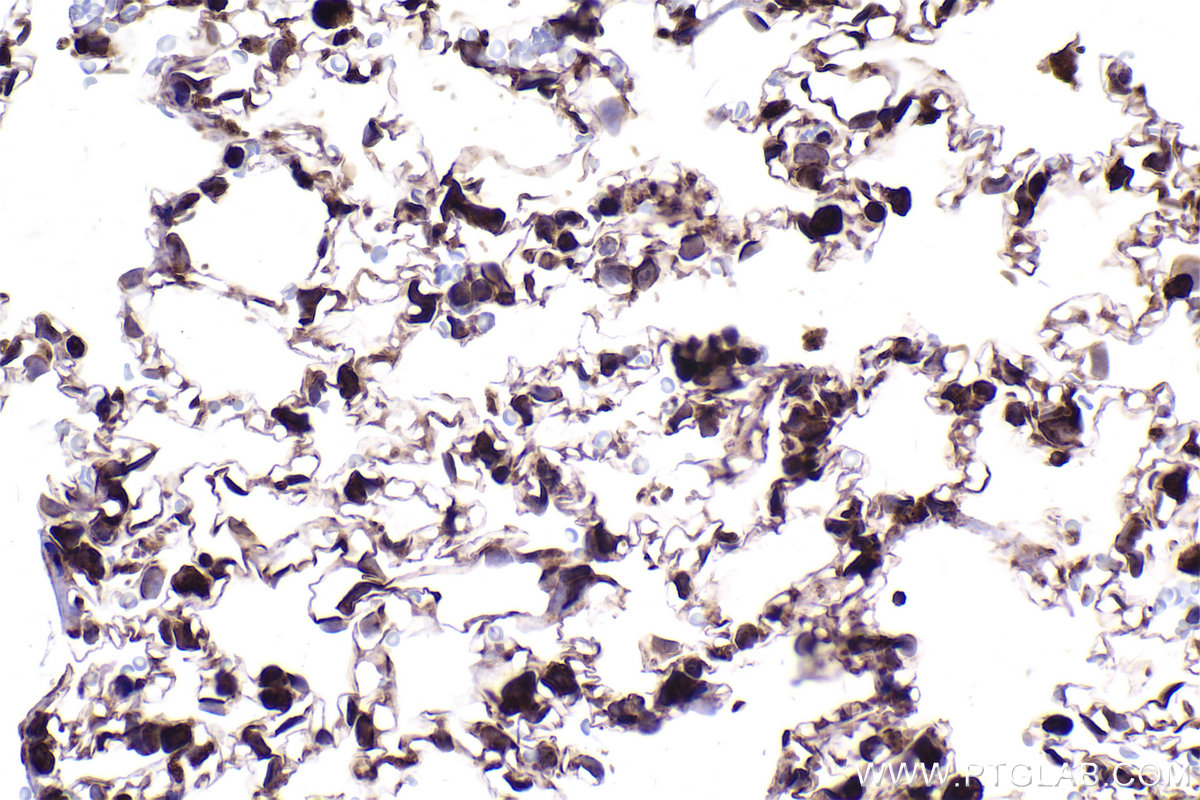 Immunohistochemical analysis of paraffin-embedded rat lung tissue slide using KHC2354 (RPL11 IHC Kit).