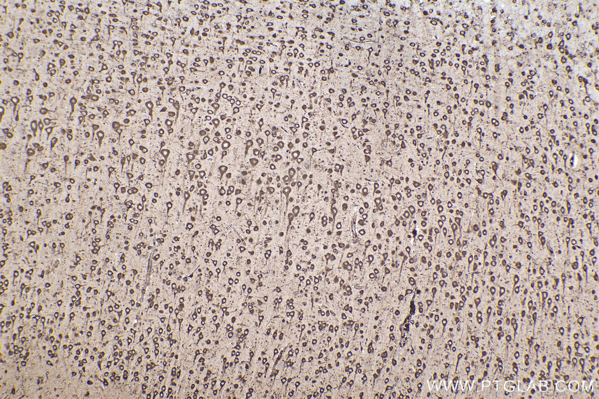 Immunohistochemical analysis of paraffin-embedded rat brain tissue slide using KHC2225 (RPL12 IHC Kit).