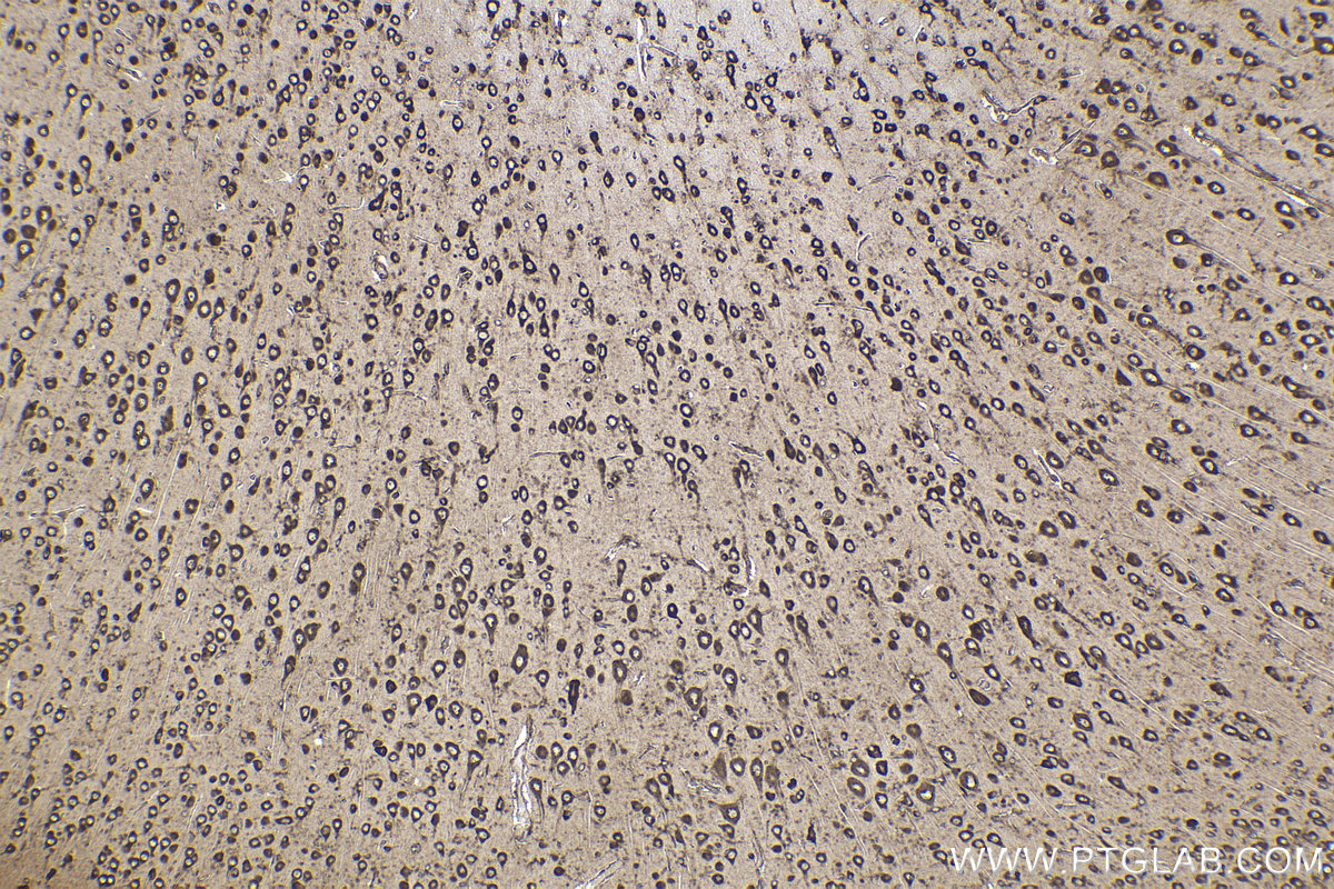 Immunohistochemical analysis of paraffin-embedded rat brain tissue slide using KHC2253 (RPL4 IHC Kit).