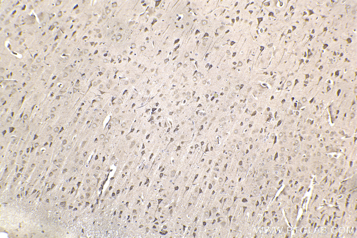 Immunohistochemical analysis of paraffin-embedded rat brain tissue slide using KHC2352 (RPS6 IHC Kit).