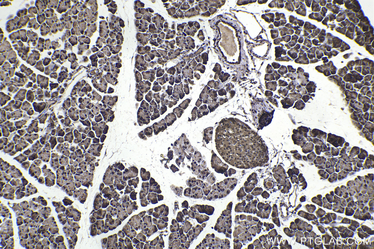 Immunohistochemical analysis of paraffin-embedded mouse pancreas tissue slide using KHC2352 (RPS6 IHC Kit).