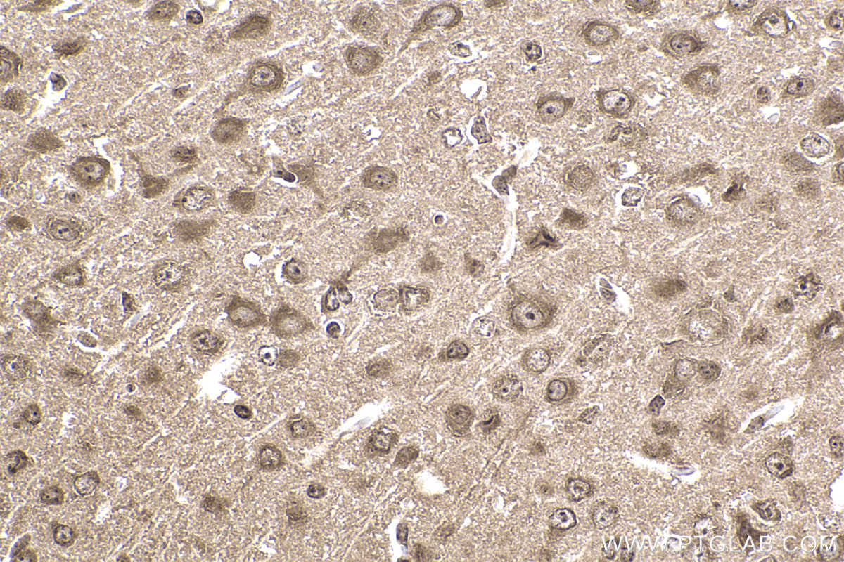 Immunohistochemical analysis of paraffin-embedded mouse brain tissue slide using KHC2352 (RPS6 IHC Kit).