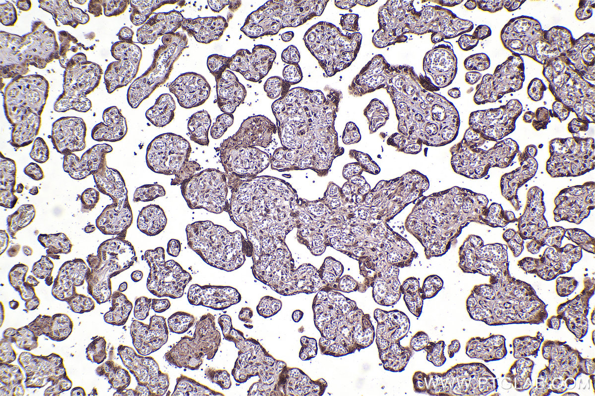 Immunohistochemical analysis of paraffin-embedded human placenta tissue slide using KHC2352 (RPS6 IHC Kit).