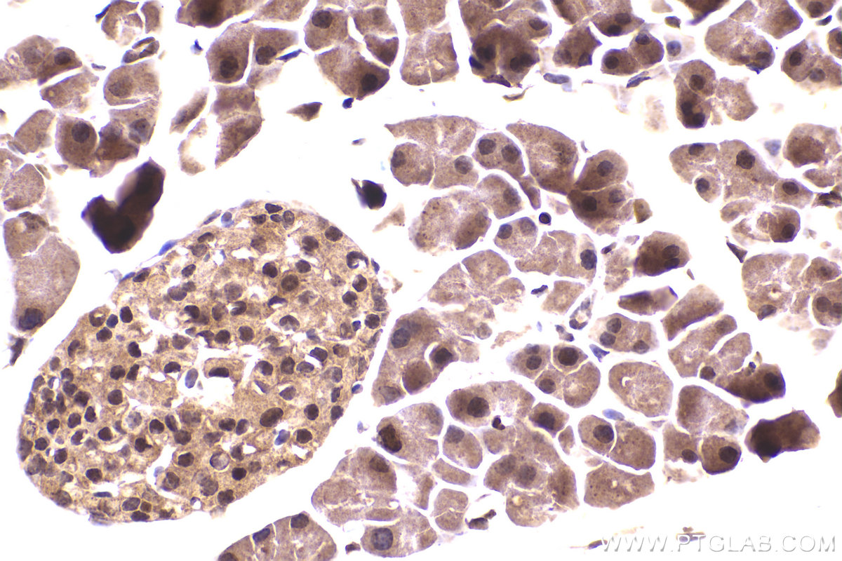 Immunohistochemical analysis of paraffin-embedded mouse pancreas tissue slide using KHC2279 (RPS9 IHC Kit).