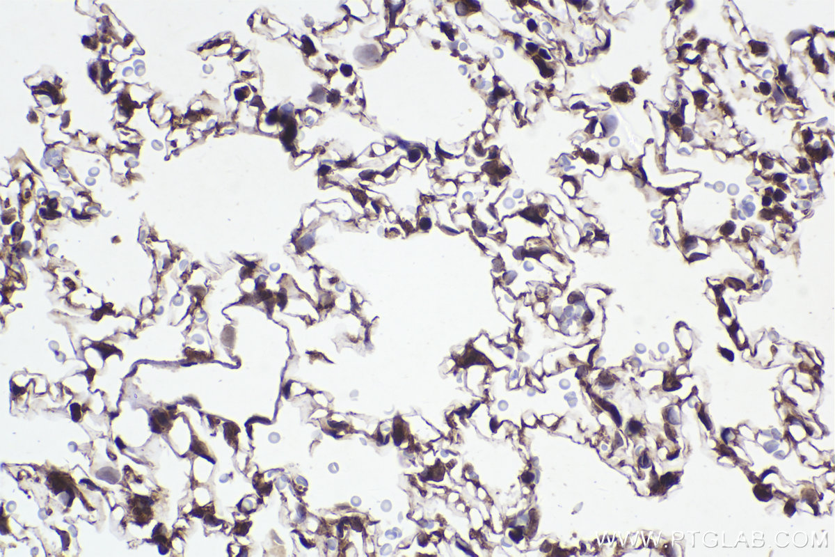 Immunohistochemical analysis of paraffin-embedded rat lung tissue slide using KHC2279 (RPS9 IHC Kit).