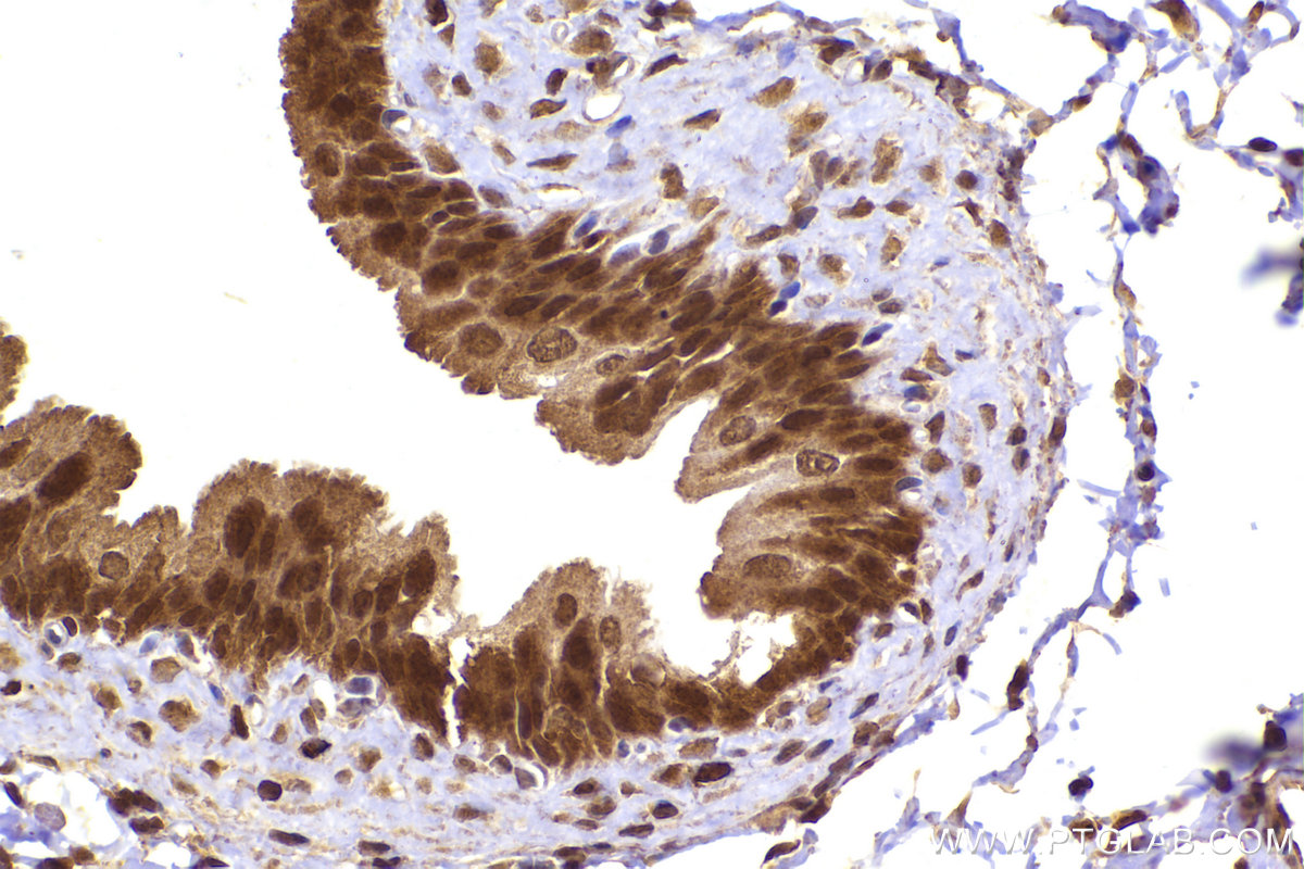 Immunohistochemical analysis of paraffin-embedded rat bladder tissue slide using KHC2233 (RRM2 IHC Kit).