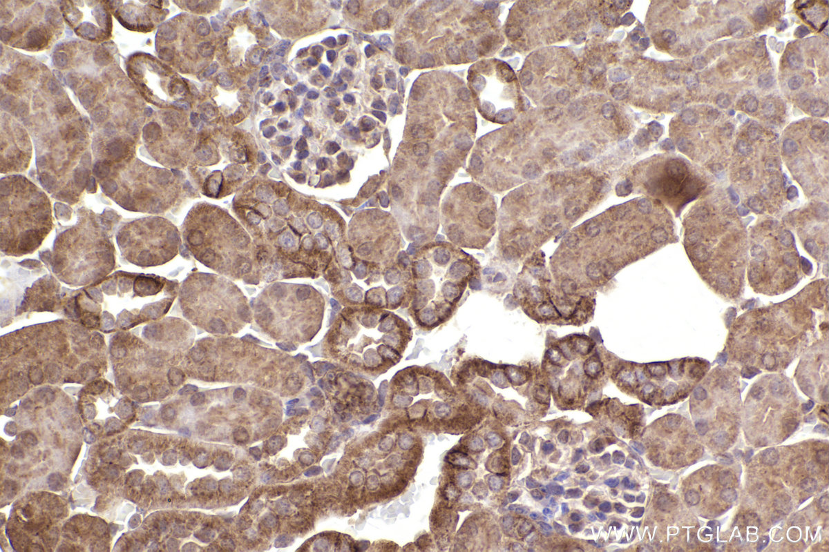 Immunohistochemical analysis of paraffin-embedded mouse kidney tissue slide using KHC2450 (SCRIB IHC Kit).