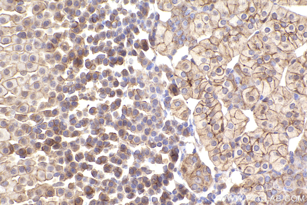 Immunohistochemical analysis of paraffin-embedded mouse adrenal gland tissue slide using KHC2450 (SCRIB IHC Kit).