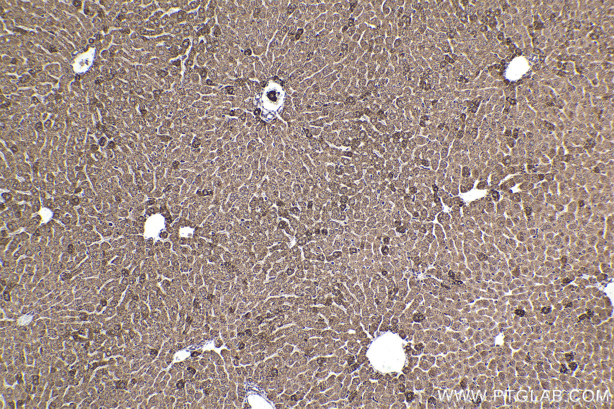 Immunohistochemical analysis of paraffin-embedded mouse liver tissue slide using KHC2231 (SDHA IHC Kit).