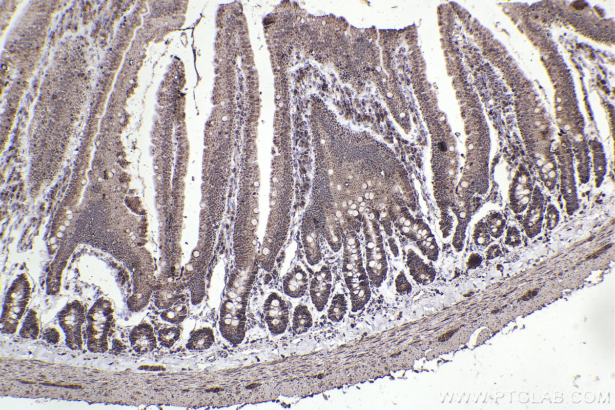 Immunohistochemical analysis of paraffin-embedded rat small intestine tissue slide using KHC2231 (SDHA IHC Kit).