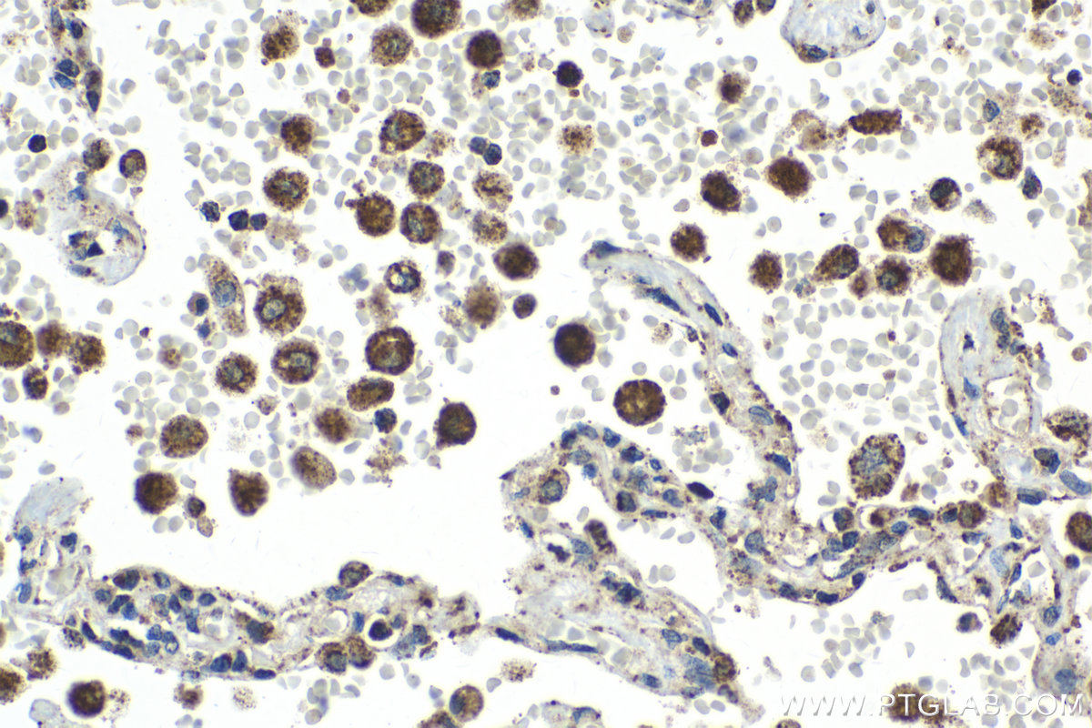 Immunohistochemical analysis of paraffin-embedded human lung tissue slide using KHC2054 (SDHD IHC Kit).