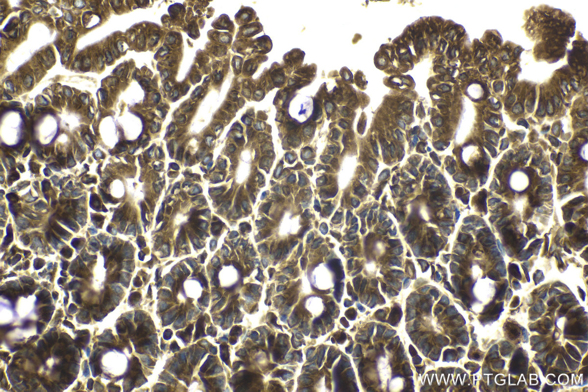 Immunohistochemical analysis of paraffin-embedded mouse small intestine tissue slide using KHC2112 (SEC22B IHC Kit).