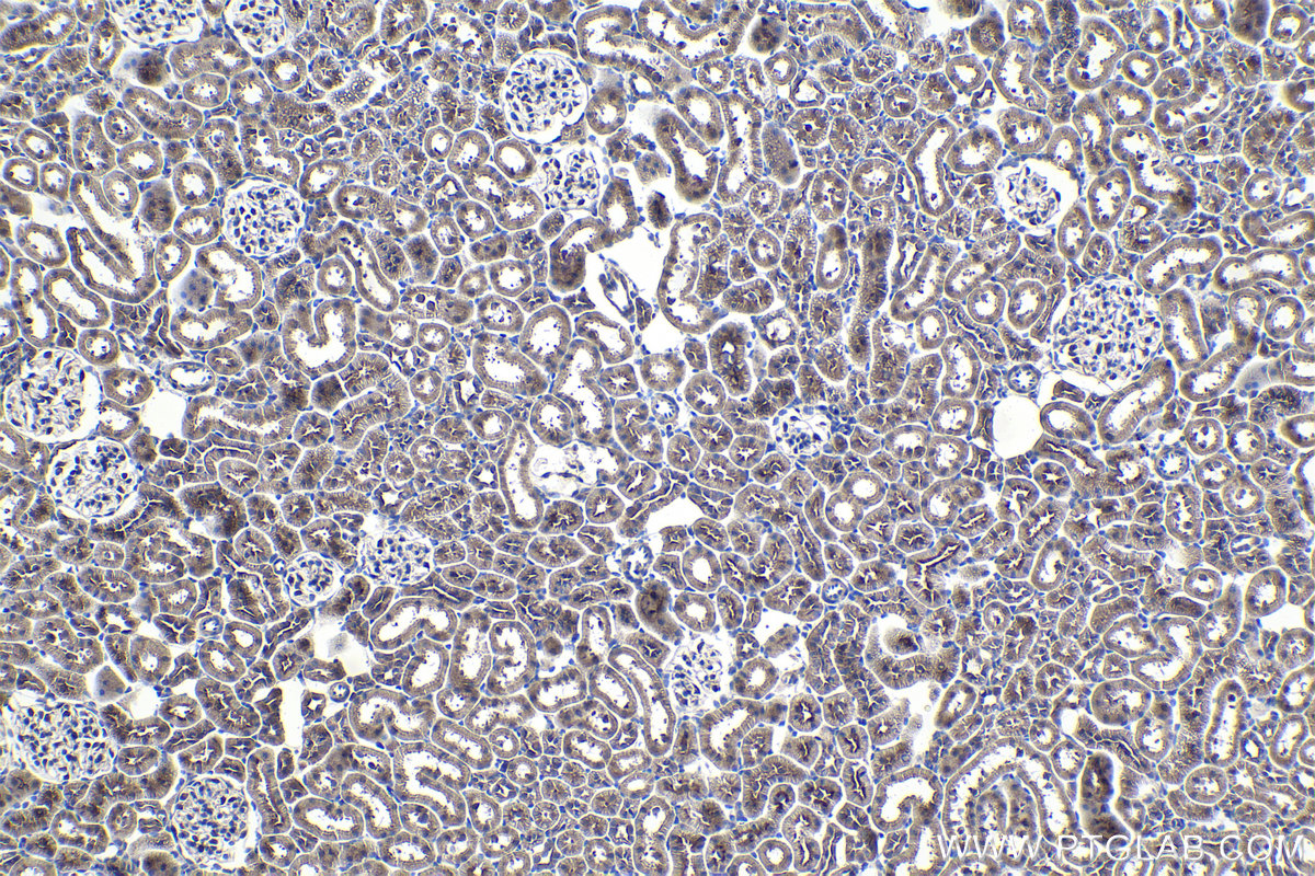 Immunohistochemical analysis of paraffin-embedded rat kidney tissue slide using KHC0994 (SEC24C IHC Kit).