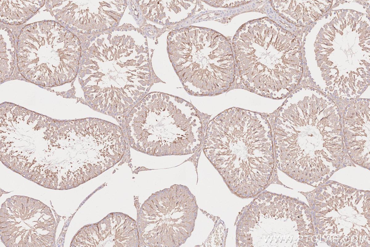 Immunohistochemical analysis of paraffin-embedded rat testis tissue slide using KHC2606 (SEPT14 IHC Kit).