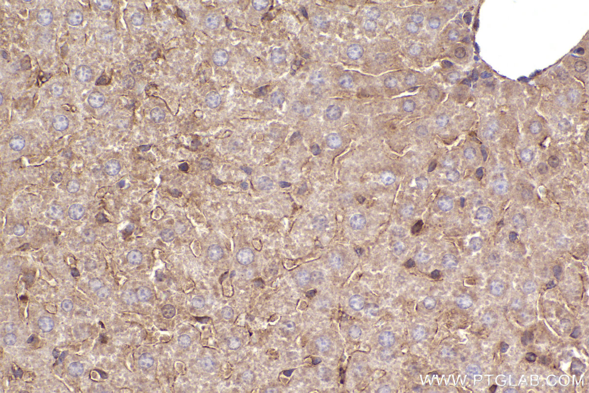 Immunohistochemical analysis of paraffin-embedded mouse liver tissue slide using KHC2448 (SEPT6 IHC Kit).