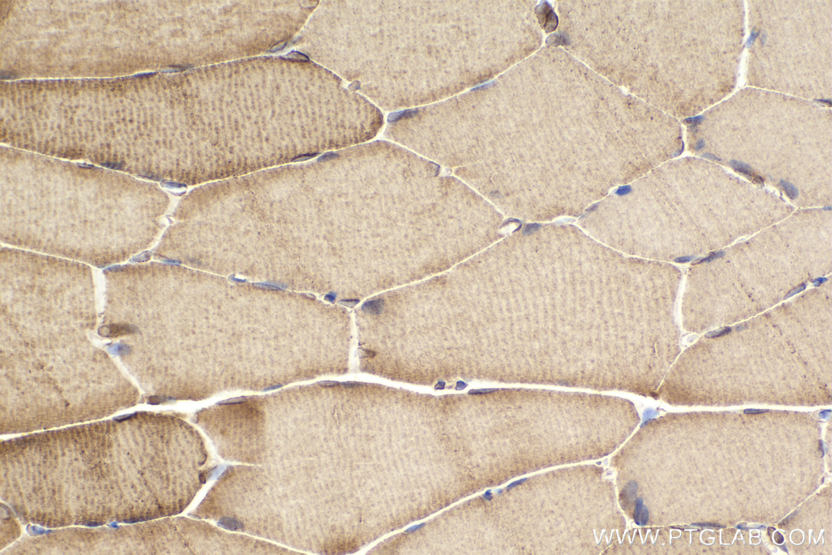 Immunohistochemical analysis of paraffin-embedded rat skeletal muscle tissue slide using KHC2194 (ATP2A2 IHC Kit).