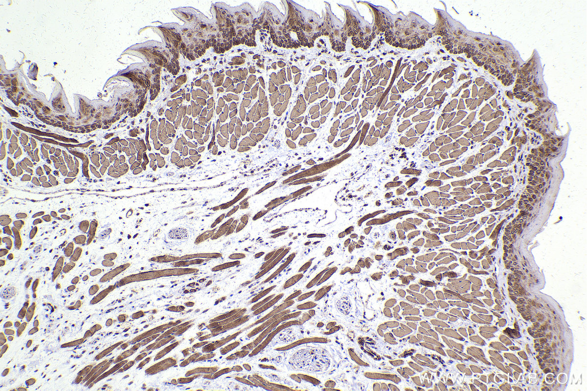 Immunohistochemical analysis of paraffin-embedded mouse tongue tissue slide using KHC2194 (ATP2A2 IHC Kit).