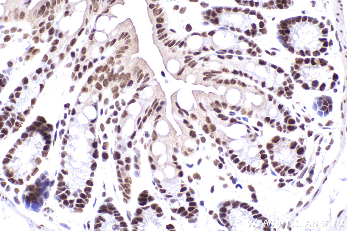 Immunohistochemical analysis of paraffin-embedded mouse colon tissue slide using KHC2427 (SF3B2 IHC Kit).