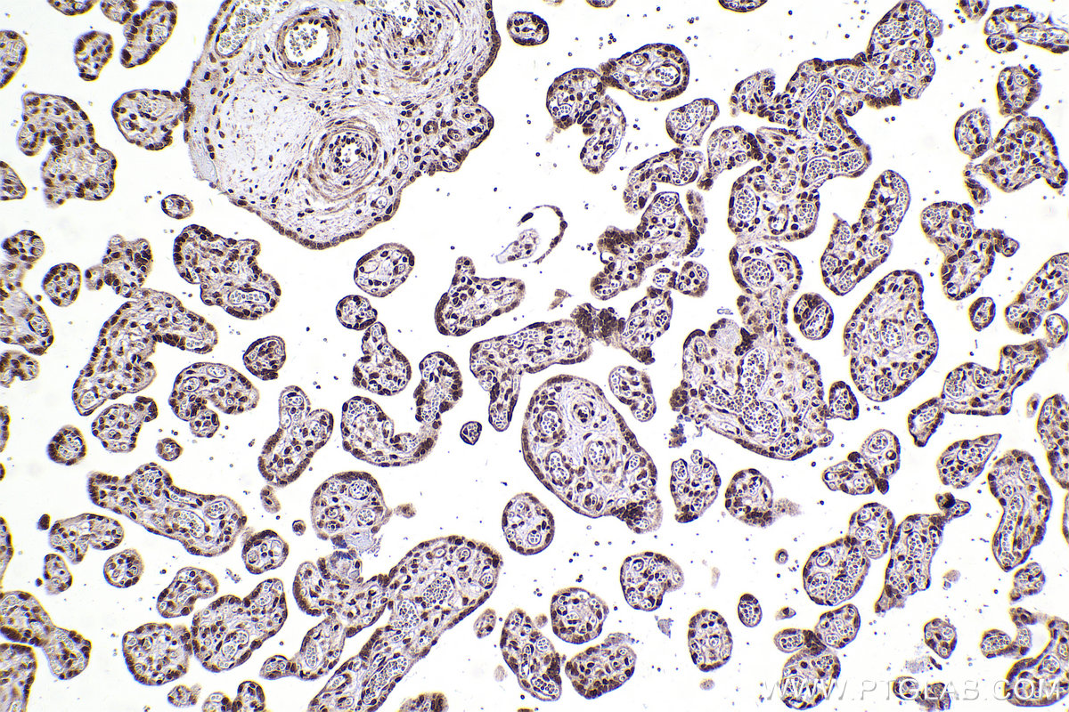 Immunohistochemical analysis of paraffin-embedded human placenta tissue slide using KHC2427 (SF3B2 IHC Kit).