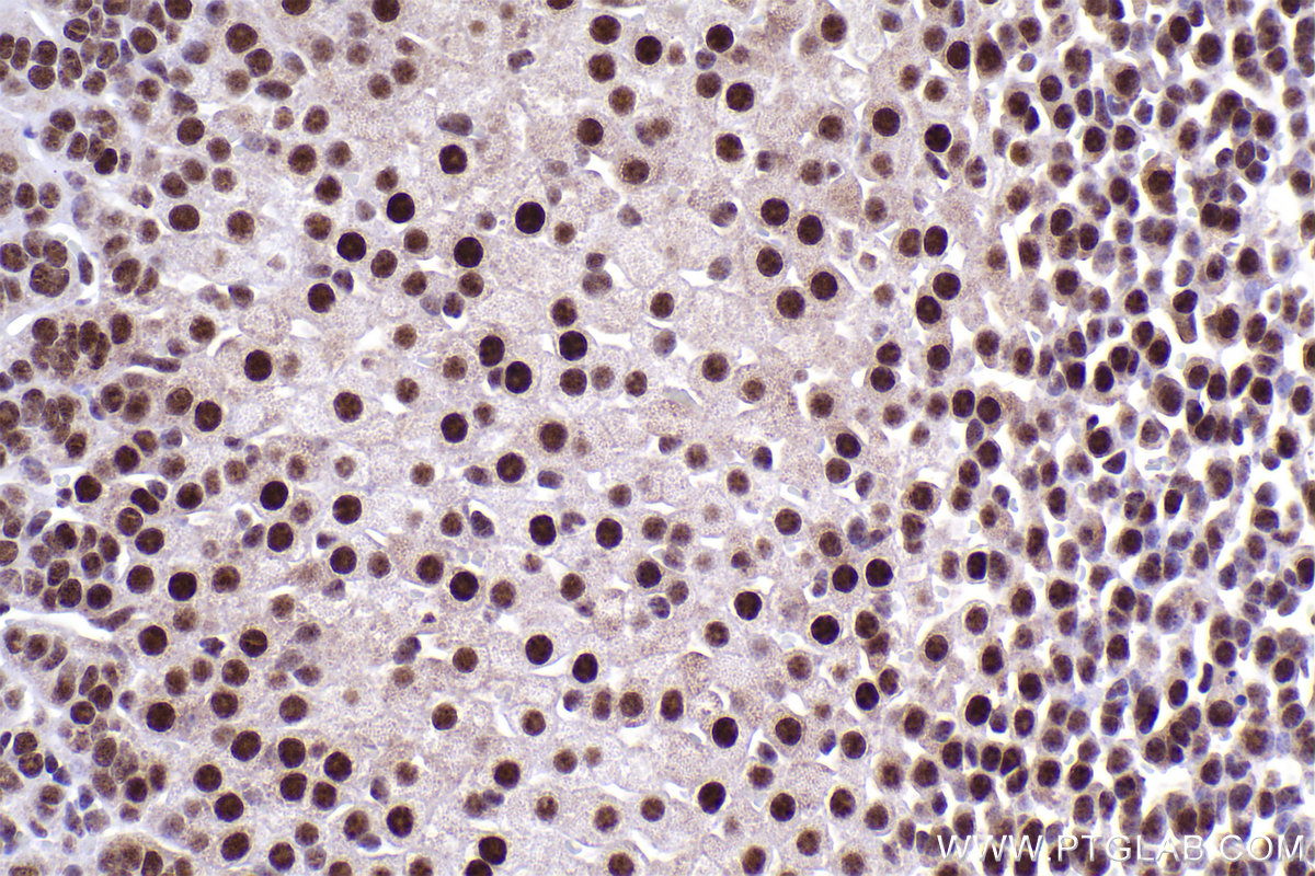 Immunohistochemical analysis of paraffin-embedded mouse adrenal gland tissue slide using KHC2427 (SF3B2 IHC Kit).