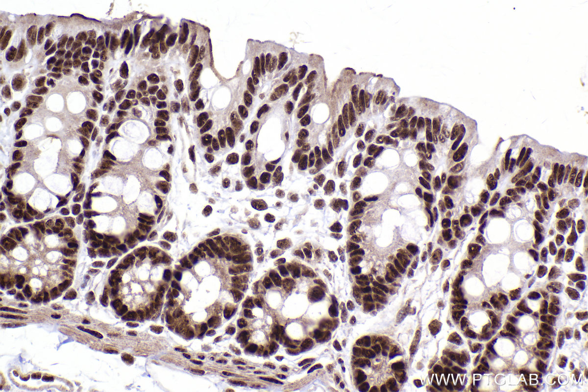 Immunohistochemical analysis of paraffin-embedded rat colon tissue slide using KHC2427 (SF3B2 IHC Kit).