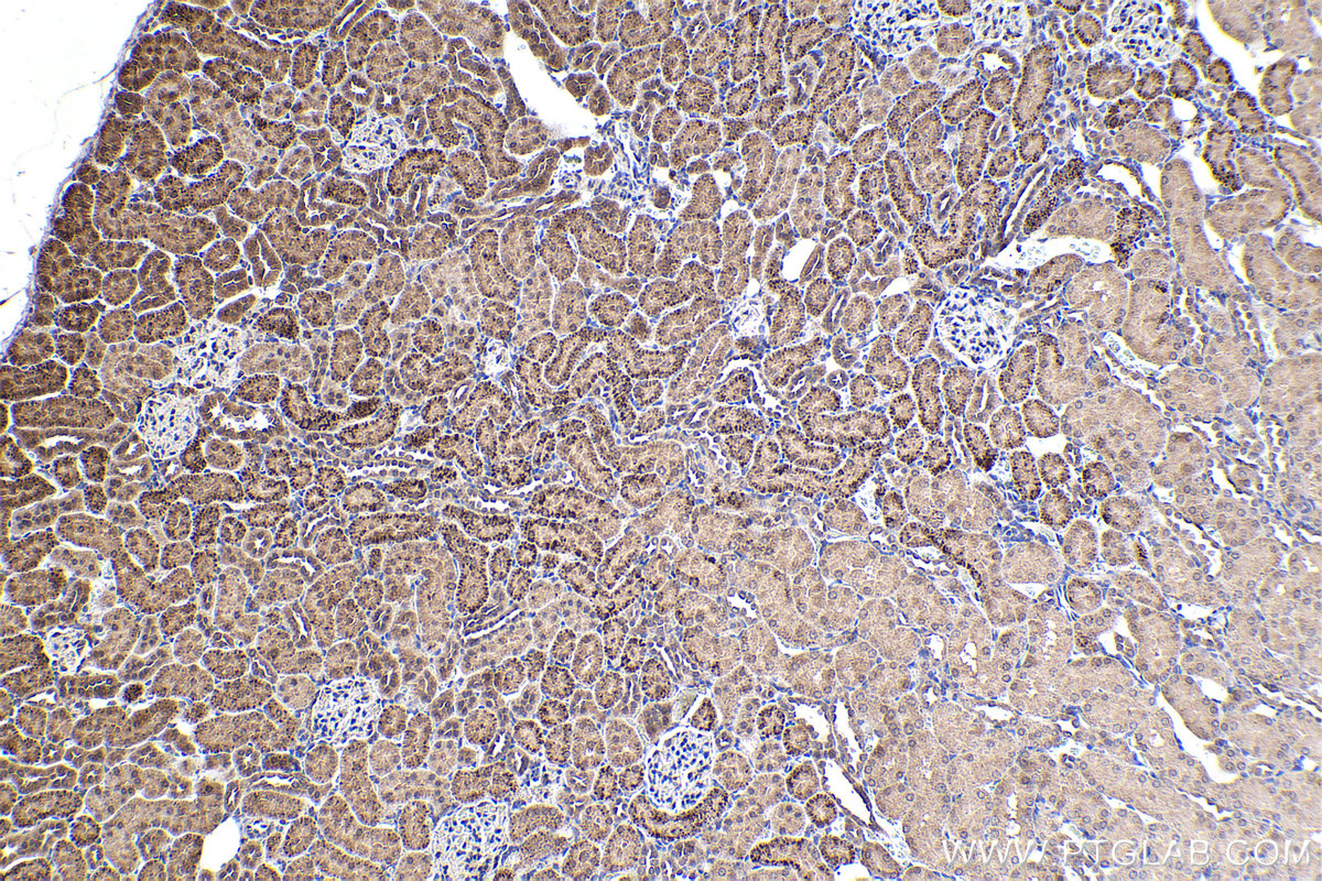 Immunohistochemical analysis of paraffin-embedded rat kidney tissue slide using KHC2241 (SHMT2 IHC Kit).