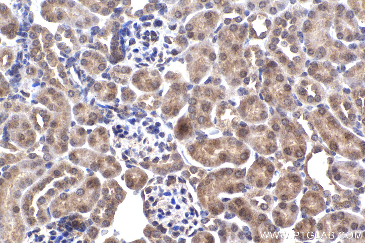 Immunohistochemical analysis of paraffin-embedded mouse kidney tissue slide using KHC2241 (SHMT2 IHC Kit).