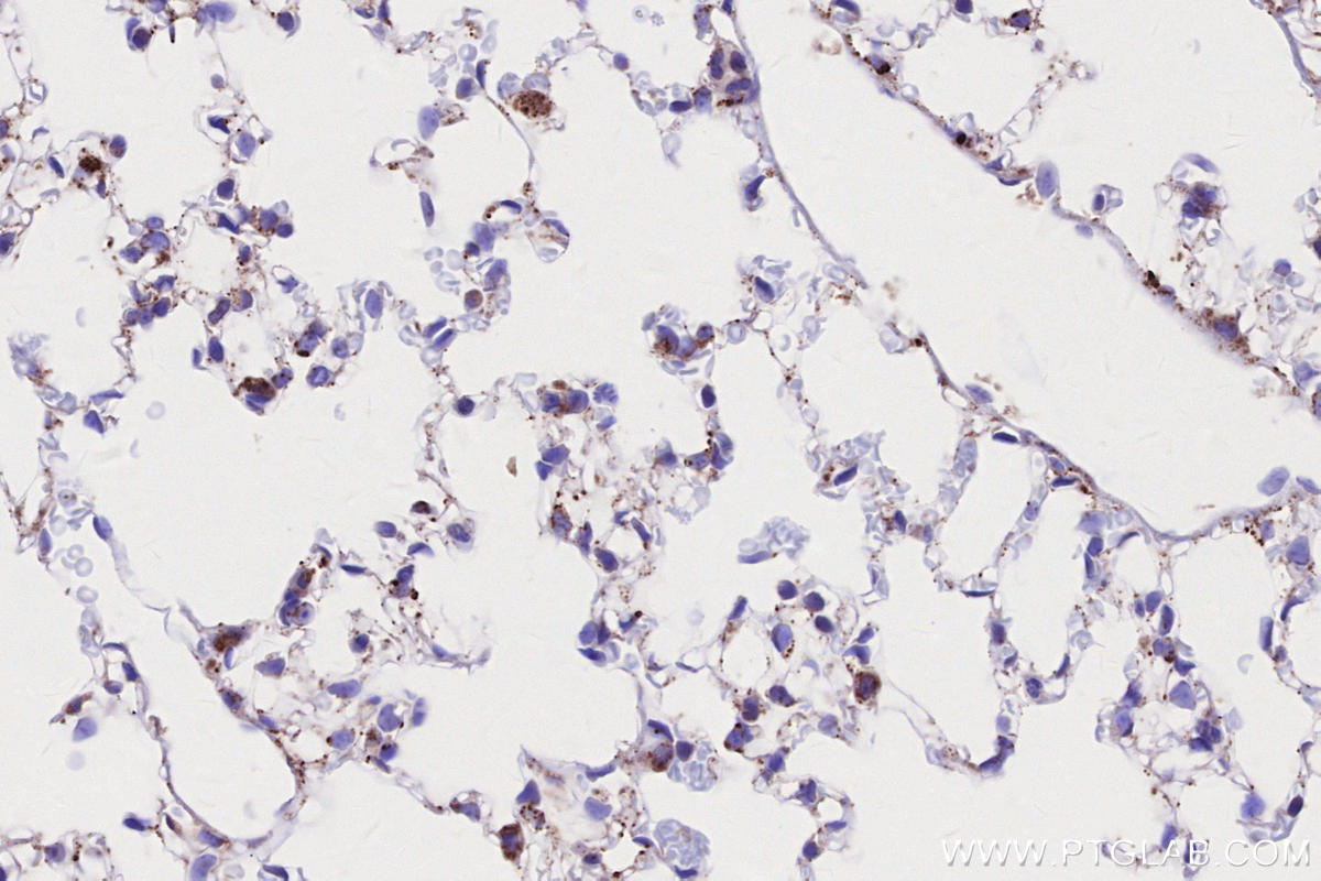 Immunohistochemical analysis of paraffin-embedded mouse lung tissue slide using KHC2643 (SIAH1 IHC Kit).