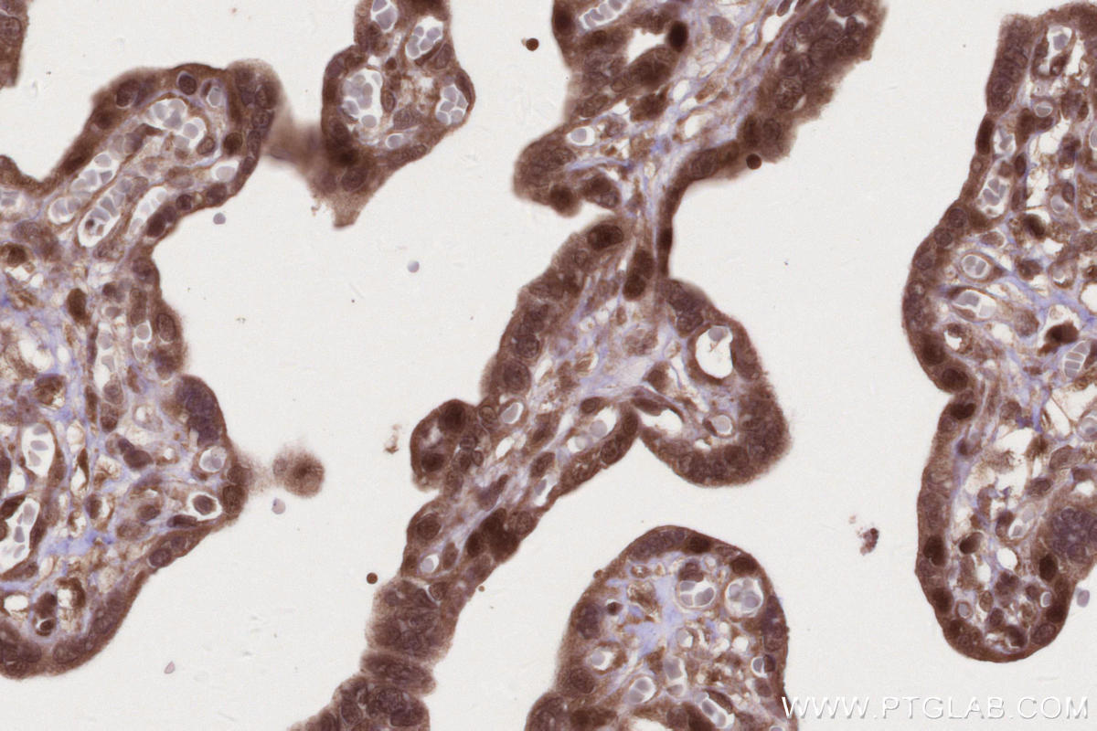 Immunohistochemical analysis of paraffin-embedded human placenta tissue slide using KHC2680 (SIRT6 IHC Kit).