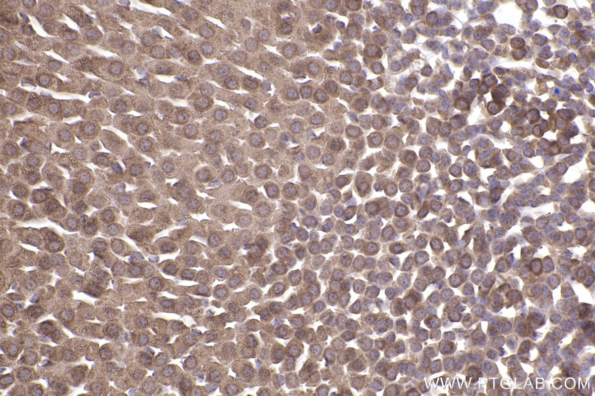 Immunohistochemical analysis of paraffin-embedded mouse adrenal gland tissue slide using KHC2490 (SKIV2L IHC Kit).