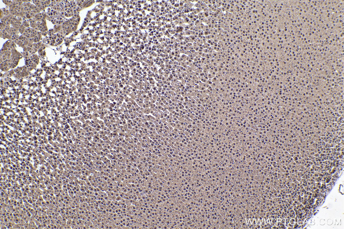 Immunohistochemical analysis of paraffin-embedded rat adrenal gland tissue slide using KHC2360 (SKP1 IHC Kit).