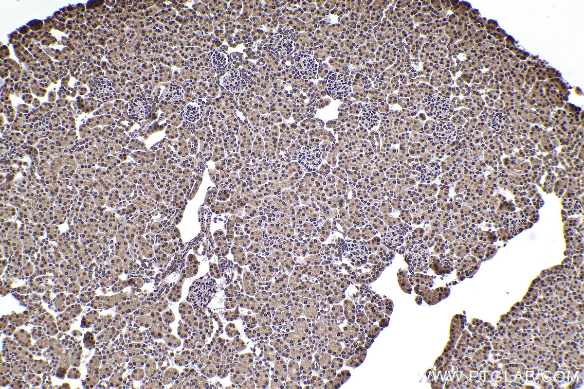 Immunohistochemical analysis of paraffin-embedded mouse kidney tissue slide using KHC2360 (SKP1 IHC Kit).