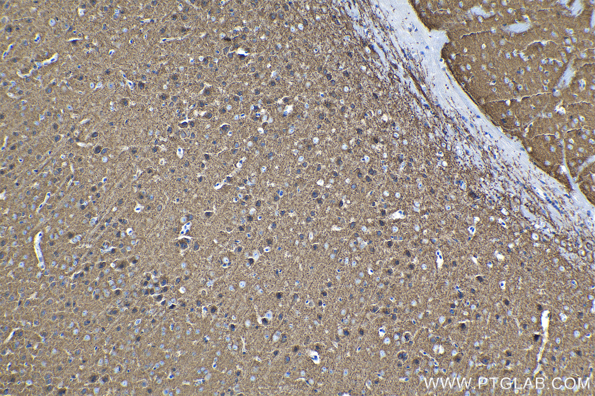 Immunohistochemical analysis of paraffin-embedded mouse brain tissue slide using KHC1344 (SLC12A5 IHC Kit).