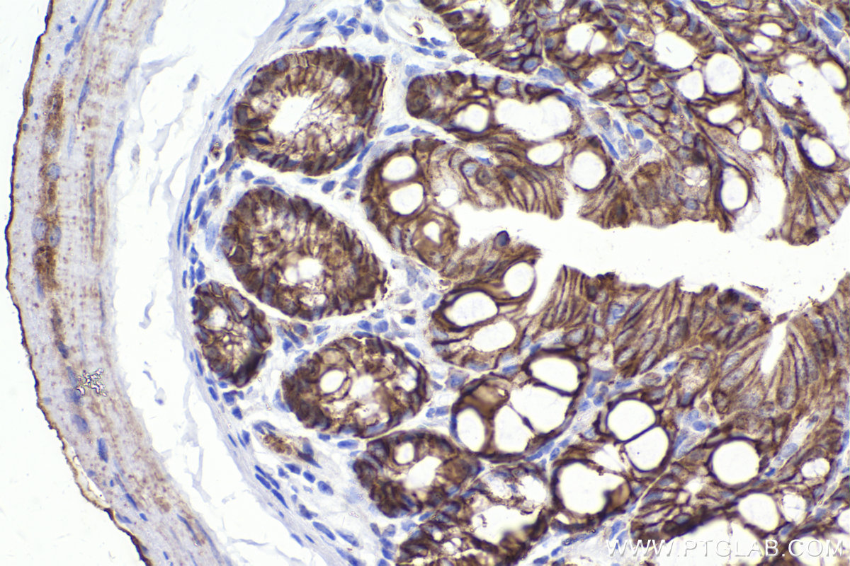 Immunohistochemical analysis of paraffin-embedded mouse colon tissue slide using KHC2321 (SLC16A1/MCT1 IHC Kit).