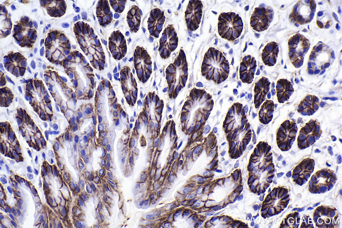 Immunohistochemical analysis of paraffin-embedded mouse stomach tissue slide using KHC2321 (SLC16A1/MCT1 IHC Kit).