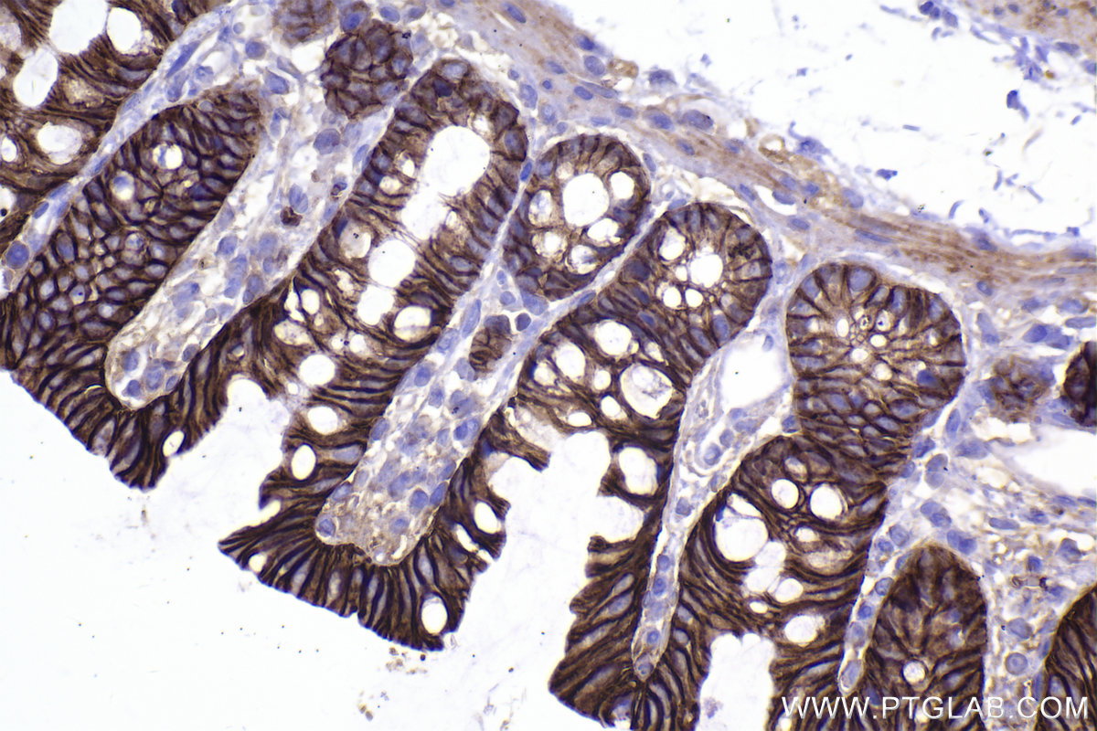 Immunohistochemical analysis of paraffin-embedded rat colon tissue slide using KHC2321 (SLC16A1/MCT1 IHC Kit).