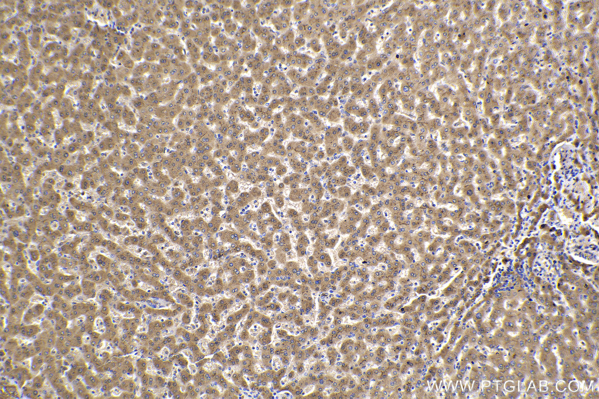 Immunohistochemical analysis of paraffin-embedded human liver tissue slide using KHC2262 (SLC1A1/EAAT3 IHC Kit).