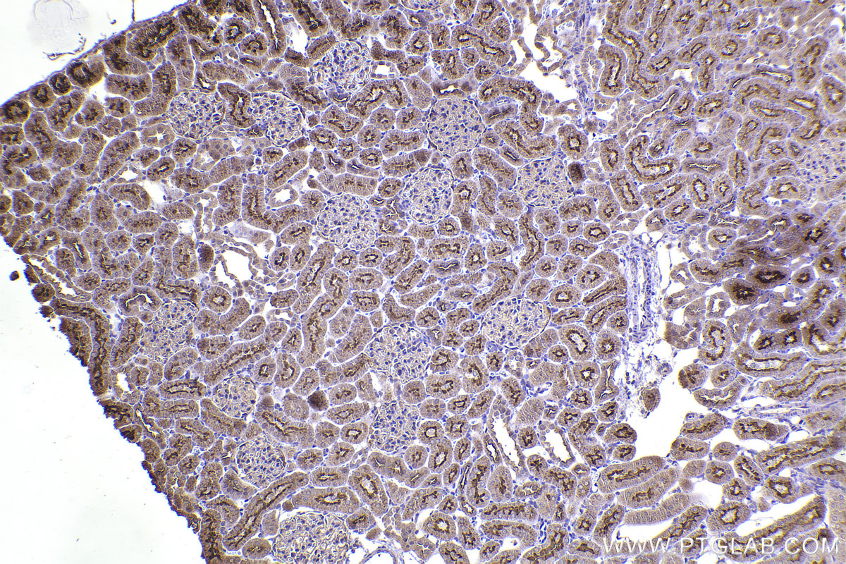 Immunohistochemical analysis of paraffin-embedded rat kidney tissue slide using KHC2262 (SLC1A1/EAAT3 IHC Kit).