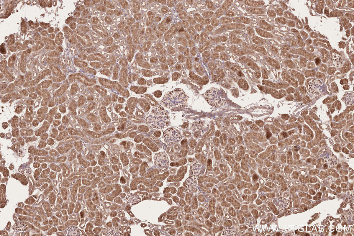 Immunohistochemical analysis of paraffin-embedded mouse kidney tissue slide using KHC2583 (SLC30A6/ZNT6 IHC Kit).