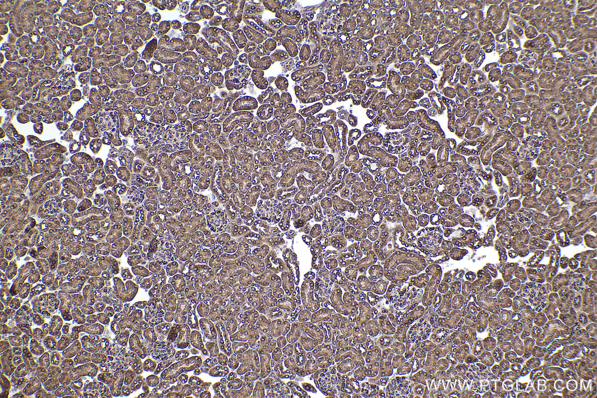 Immunohistochemical analysis of paraffin-embedded mouse kidney tissue slide using KHC2384 (SLC7A5 IHC Kit).