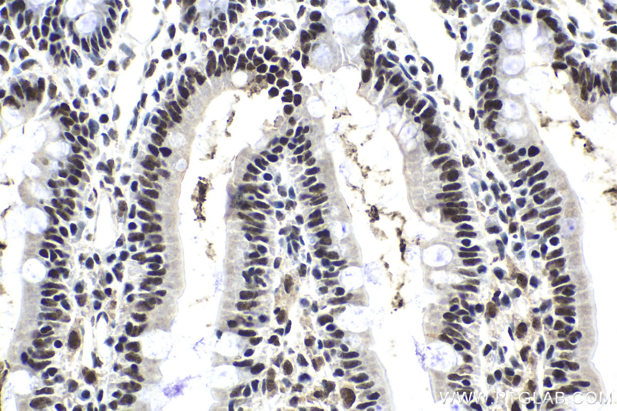 Immunohistochemical analysis of paraffin-embedded rat small intestine tissue slide using KHC1967 (SLTM IHC Kit).