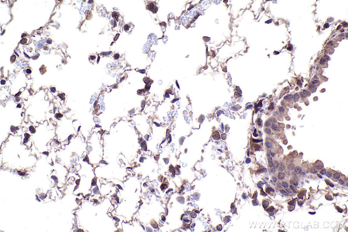 Immunohistochemical analysis of paraffin-embedded mouse lung tissue slide using KHC2372 (SMAD3 IHC Kit).