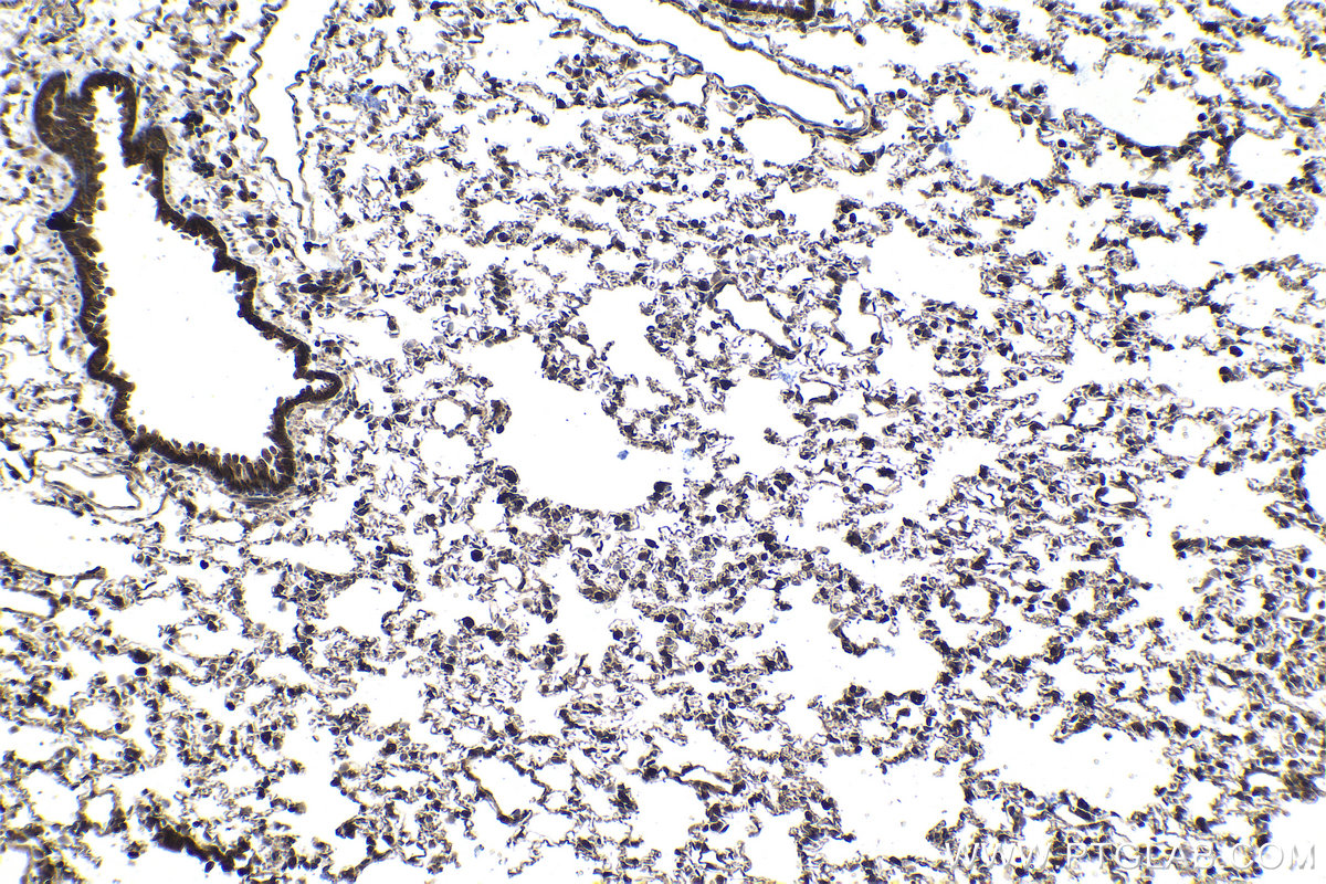 Immunohistochemical analysis of paraffin-embedded rat lung tissue slide using KHC1441 (SMAD9 IHC Kit).
