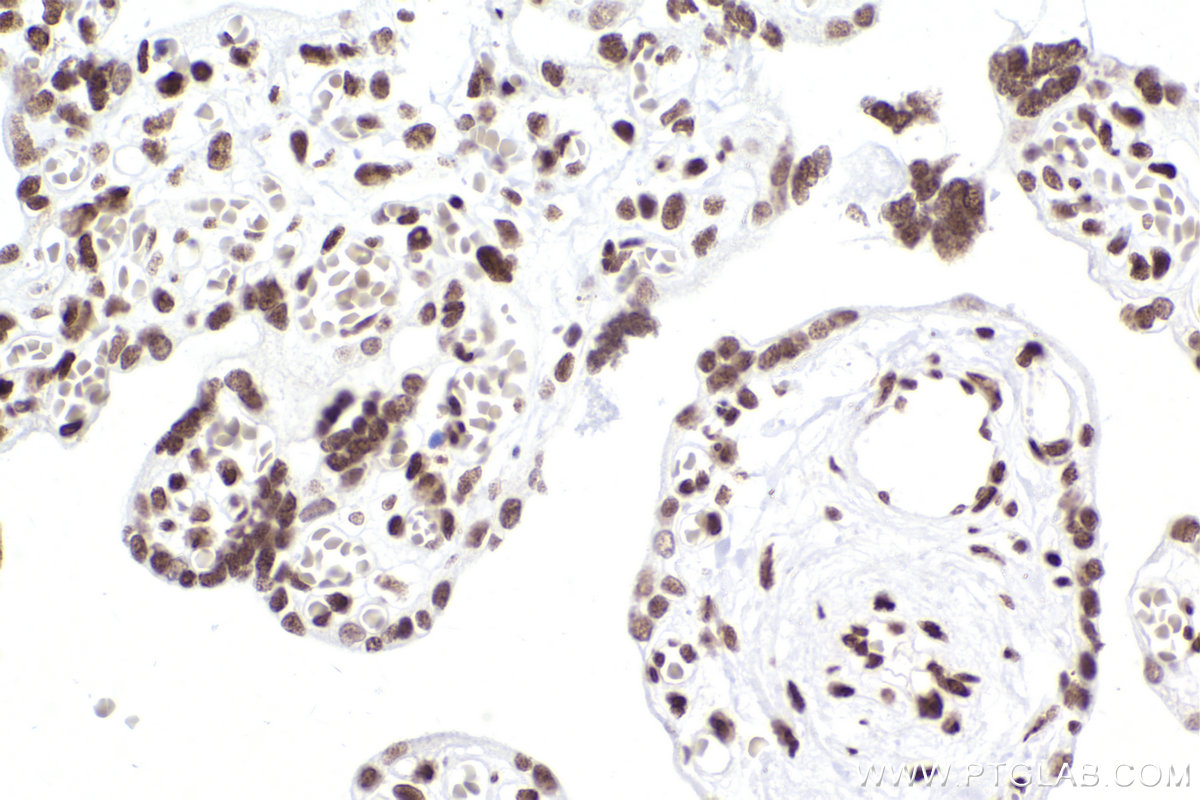 Immunohistochemical analysis of paraffin-embedded human placenta tissue slide using KHC2303 (SMARCA4 IHC Kit).