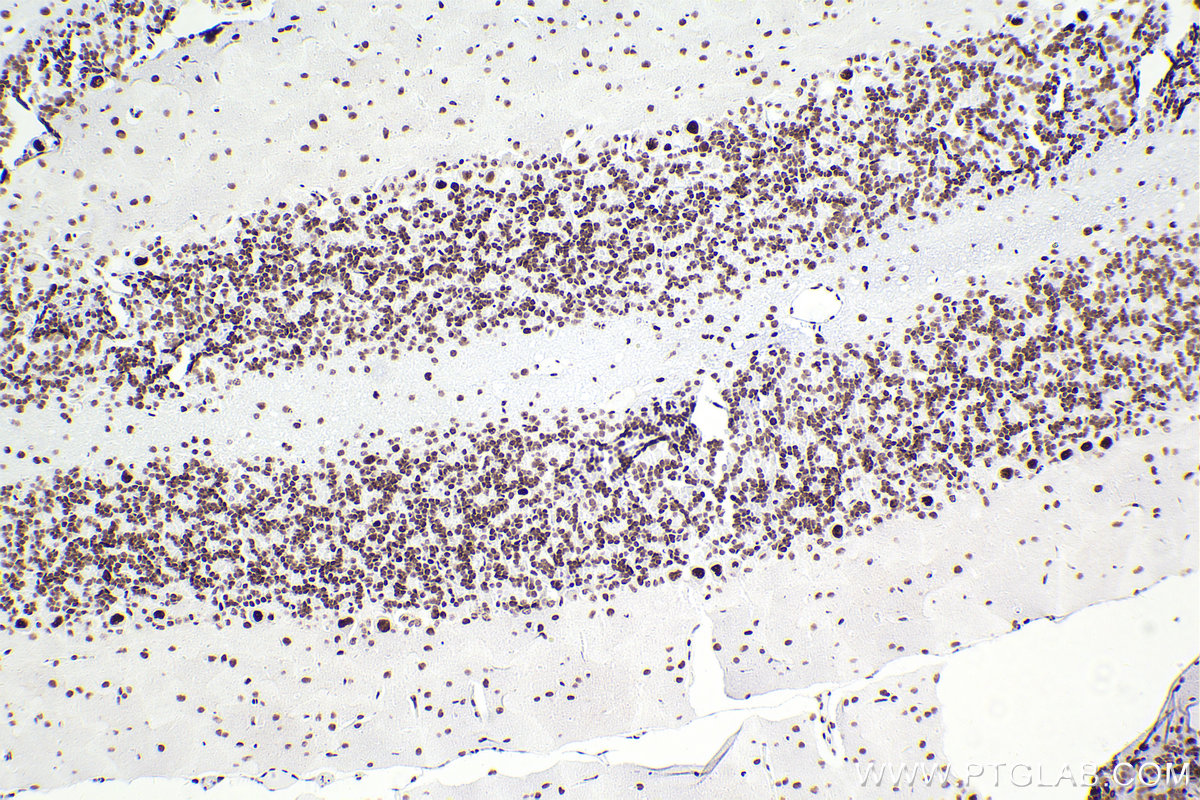 Immunohistochemical analysis of paraffin-embedded rat cerebellum tissue slide using KHC2303 (SMARCA4 IHC Kit).