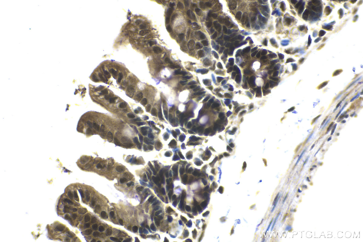 Immunohistochemical analysis of paraffin-embedded mouse intestine tissue slide using KHC2143 (SMC2 IHC Kit).